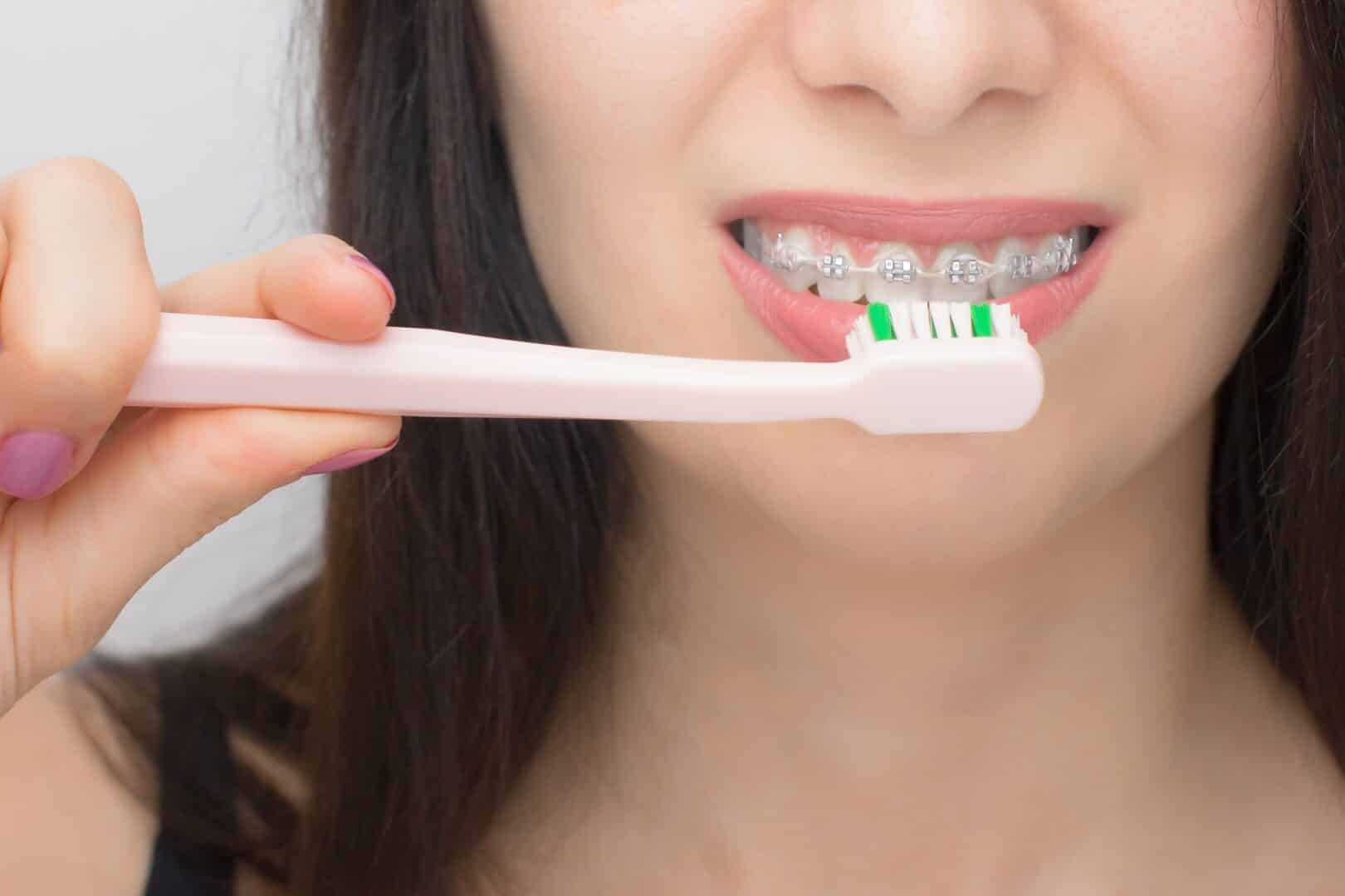 dents du bonheur traitement orthodontique